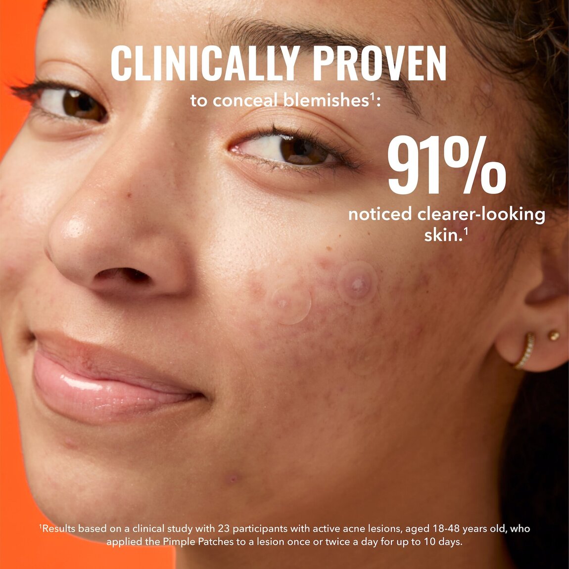 pimple-patches-f7 zb_p.jpg