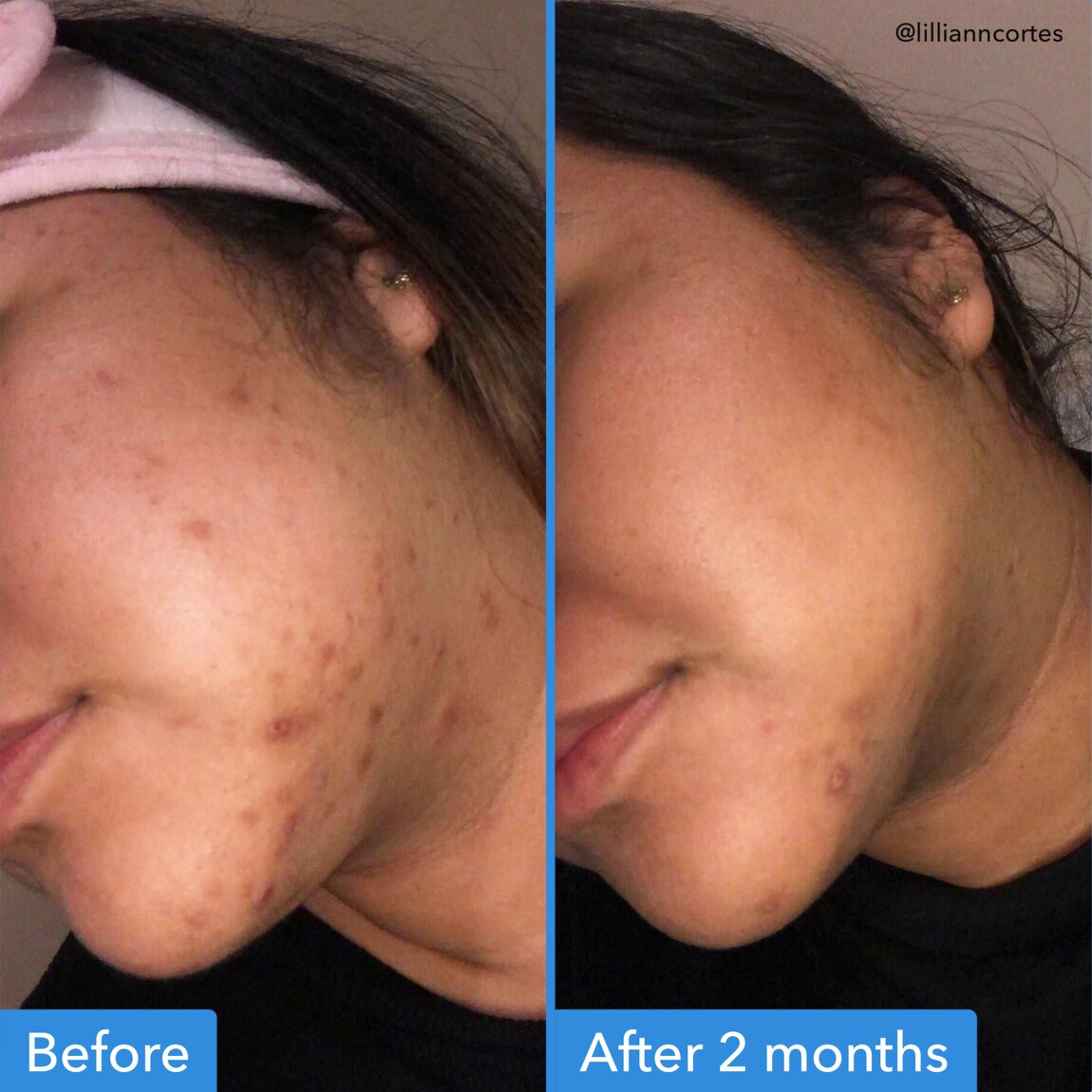 discoloration-correcting-serum-g6 zb_p.jpg