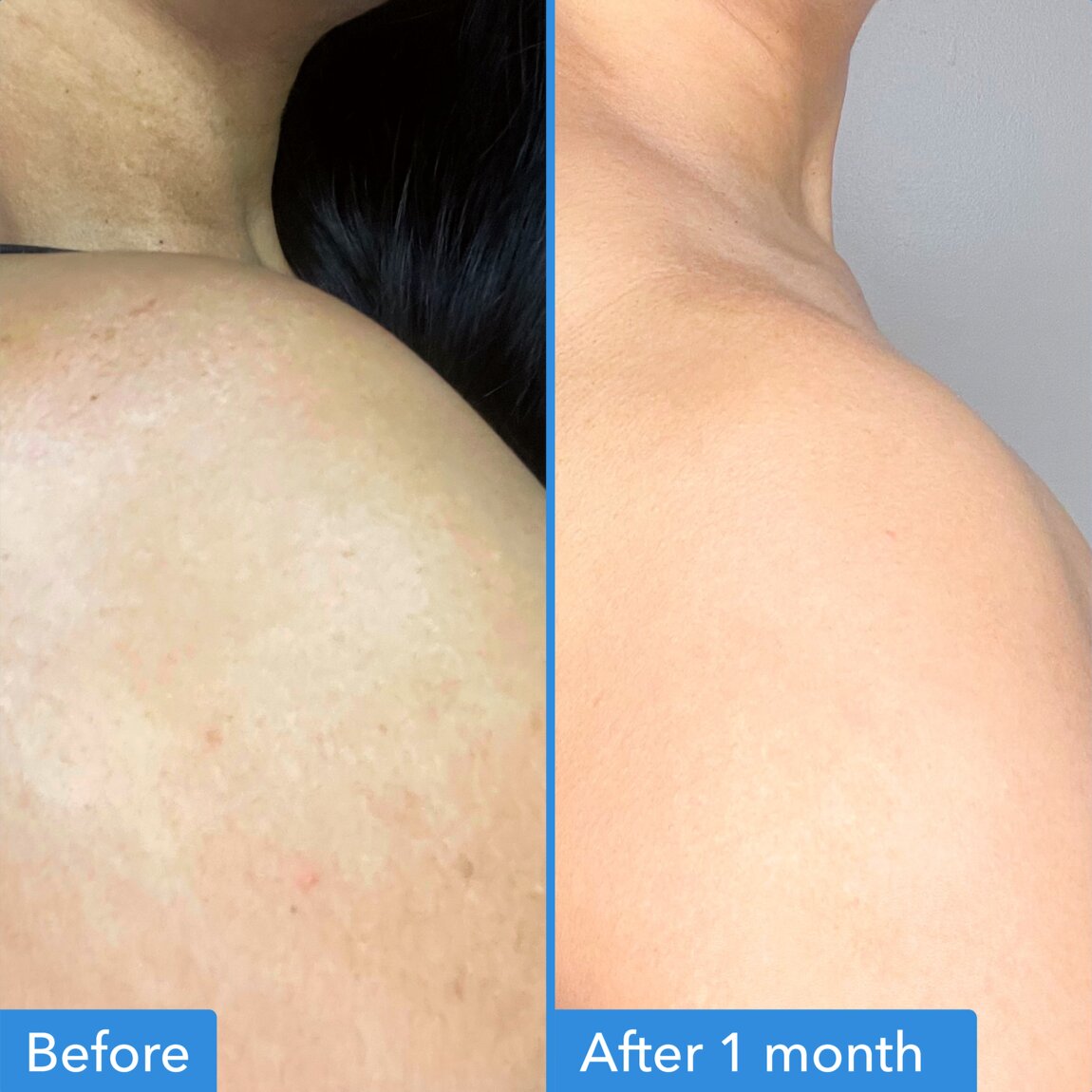 discoloration-correcting-body-treatment-g2 zb_p.jpg