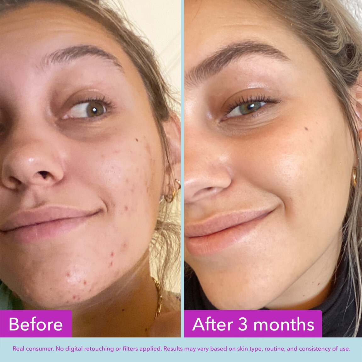 niacinamide-brightening-toner-y1 zb_p.jpg